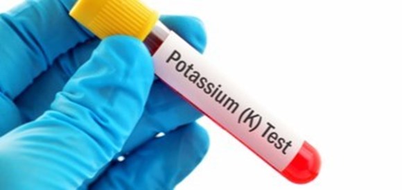 בדיקת רמת אשלגן (Potassium) - תמונה